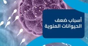 أسباب ضعف الحيوانات المنوية عند الرجال وطرق العلاج الفعالة التي يمكن اتباعها
