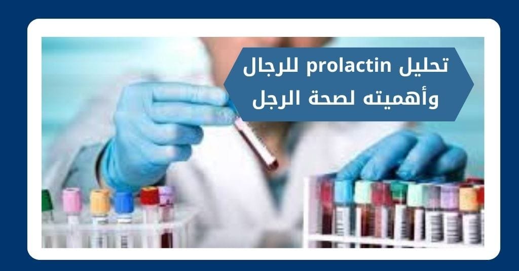 تحليل prolactin للرجال وأهميته لصحة الرجل وخصوبته بدقة
