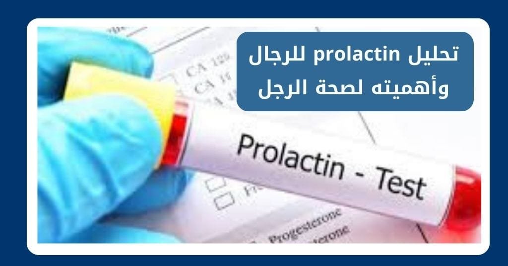 تحليل prolactin للرجال وأهميته لصحة الرجل وخصوبته بدقة1