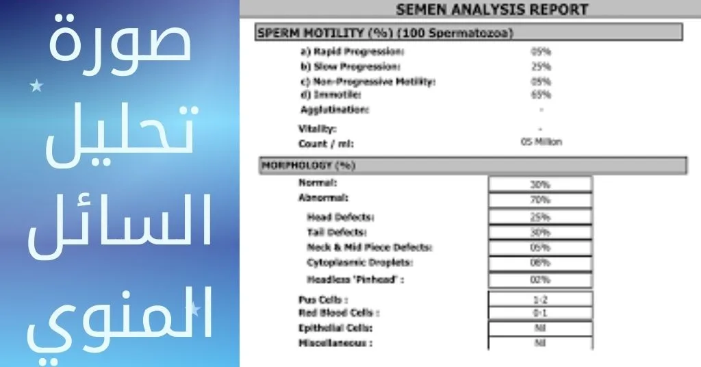 صورة تحليل السائل المنوي