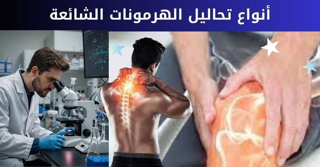 أنواع تحاليل الهرمونات الشائعة