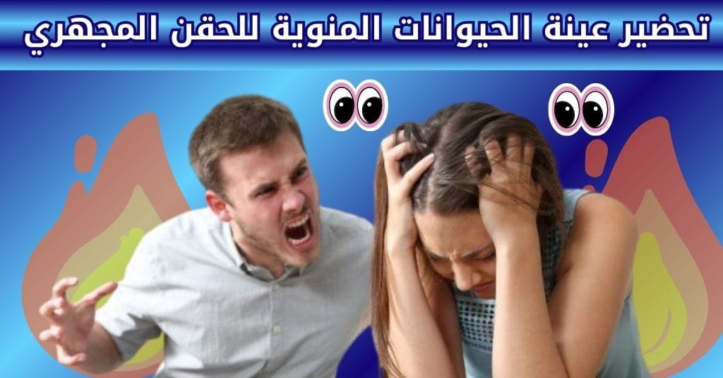 تحضير عينة الحيوانات المنوية للحقن المجهري